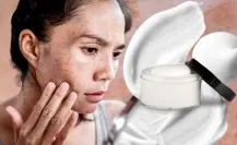 5 maneras de quitar manchas del rostro de forma efectiva y sin gastar de más