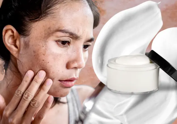5 maneras de quitar manchas del rostro de forma efectiva y sin gastar de más