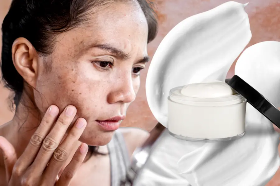 5 maneras de quitar manchas del rostro de forma efectiva y sin gastar de más