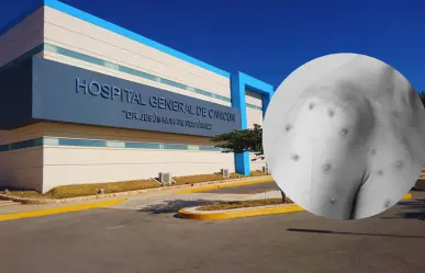 Viruela símica cobra una víctima en Quintana Roo; es la primera del año