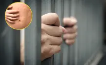 Descartan caso de sarampión de reo en Piedras Negras, era sarna