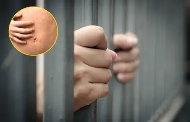 Descartan caso de sarampión de reo en Piedras Negras, era sarna