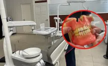 Dientes manchados en Durango: esta es la causa más común de este problema de salud bucal
