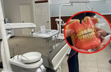 Dientes manchados en Durango: esta es la causa más común de este problema de salud bucal