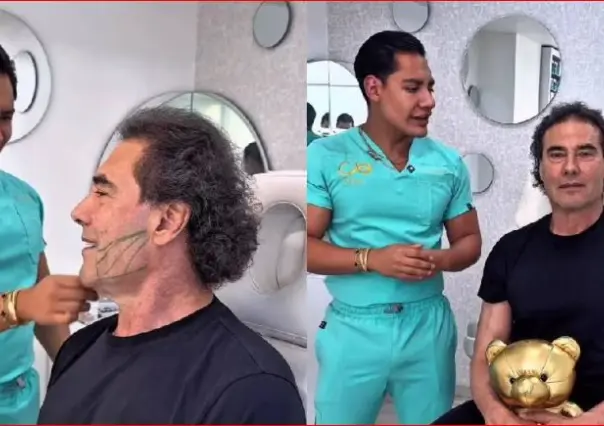 Eduardo Yáñez estrena rostro: esto se hizo el actor