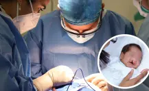 ¡Atención gratuita! Así puedes acceder a cirugía de labio y paladar hendido en Saltillo