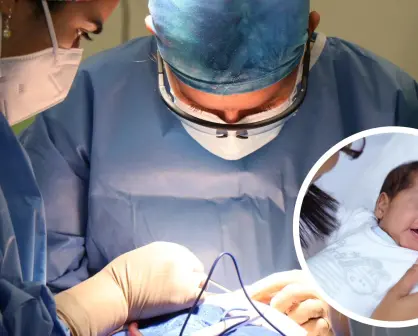 ¡Atención gratuita! Así puedes acceder a cirugía de labio y paladar hendido en Saltillo