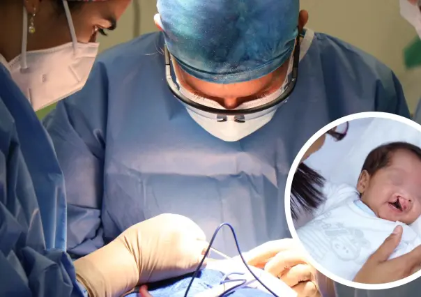 ¡Atención gratuita! Así puedes acceder a cirugía de labio y paladar hendido en Saltillo