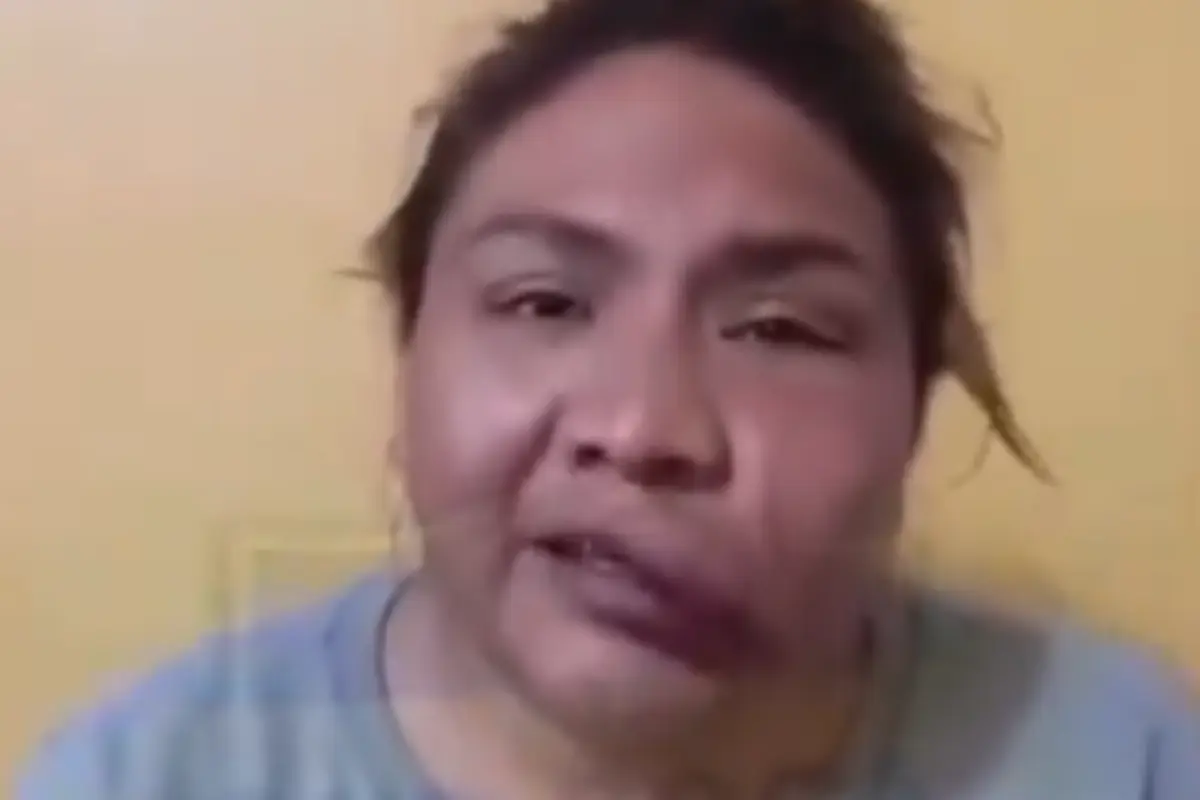 Mujer trans sufre ataque en Naucalpan Edomex. Foto: X (@QuePocaMadre_Mx)