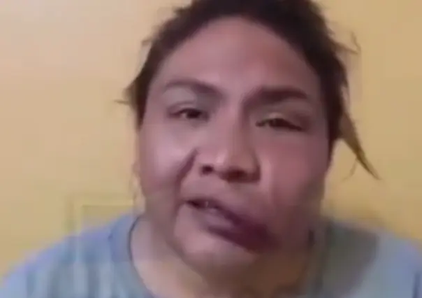 VIDEO | Mujer trans denuncia agresión por policías de Naucalpan, colectivos exigen alto a la violencia