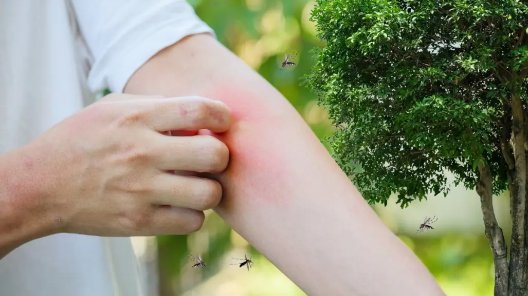 Esos árboles en Coahuila son repélense naturales de mosquitos para el hogar, ¿los conoces? 