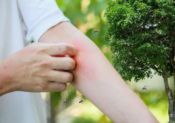 Esos árboles en Coahuila son repélense naturales de mosquitos para el hogar, ¿los conoces? 
