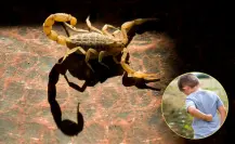 Pica alacrán a niño en Arteaga, exhortan a tomar precauciones en zonas rurales