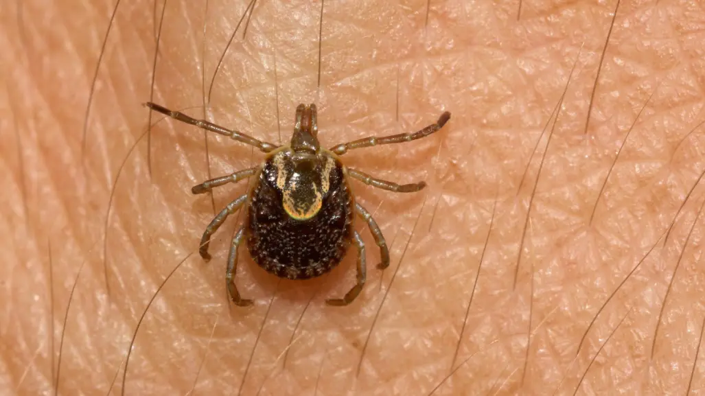 ¿Cuántos decesos suma La Laguna por picadura de garrapata?