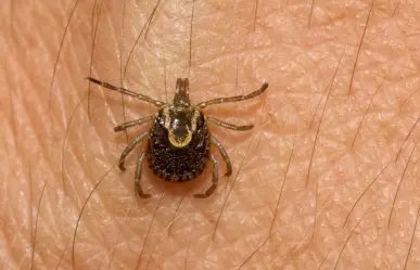 ¿Cuántos decesos suma La Laguna por picadura de garrapata?