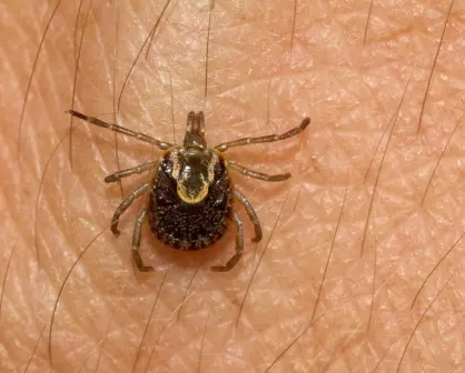 ¿Cuántos decesos suma La Laguna por picadura de garrapata?