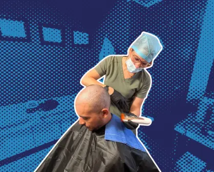 Injerto capilar: el procedimiento que transforma la imagen de los hombres