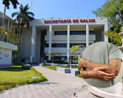 Confirman caso de Mpox en paciente hospitalizado en Chiapas