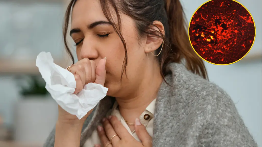 Tuberculosis en Coahuila; ¿cuántos casos hay y qué es esta enfermedad?