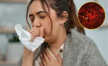 Tuberculosis en Coahuila; ¿cuántos casos hay y qué es esta enfermedad?