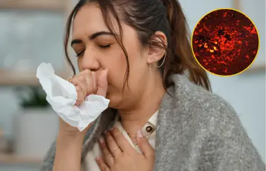 Tuberculosis en Coahuila; ¿cuántos casos hay y qué es esta enfermedad?