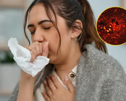 Tuberculosis en Coahuila; ¿cuántos casos hay y qué es esta enfermedad?