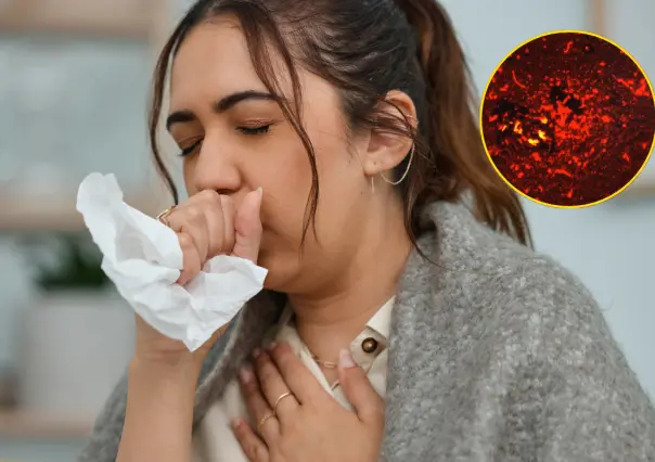 Tuberculosis en Coahuila; ¿cuántos casos hay y qué es esta enfermedad?