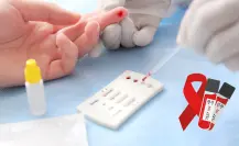 La peligrosa enfermedad incurable que contagia a 3 personas por semana en Durango