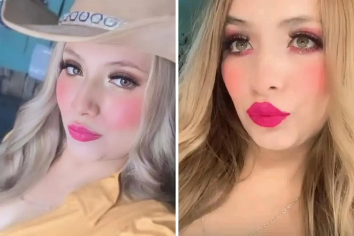 Jaqueline Yamilet Briones Torres, joven de 25 años que murió tras someterse a una cirugía estética. Foto: Composición Canva