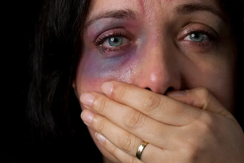 Mujer con un moretón en la cara. Foto: Canva
