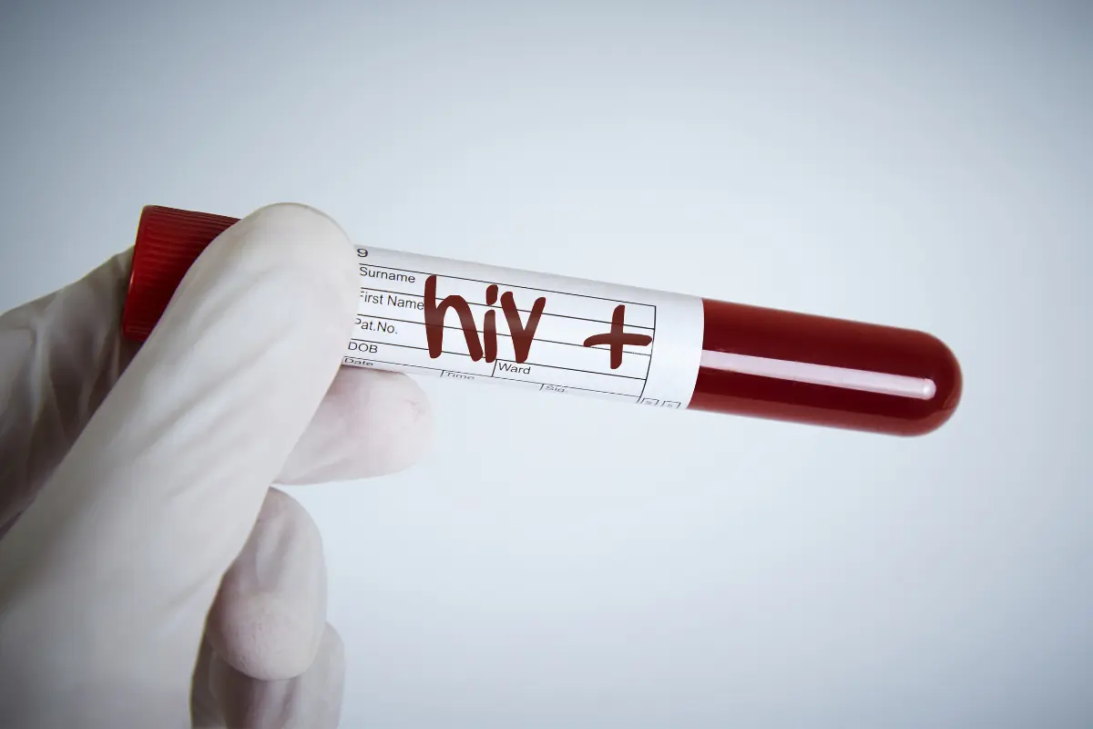 En caso de que el resultado de VIH o Hepatitis C sea reactivo, el paciente es canalizado al servicio de salud correspondiente, como IMSS o ISSSTE, o bien recibe atención directamente en CAPASITS./Foto: Canva