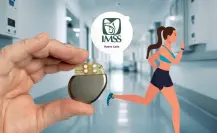 Conoce a la atleta fit que vive al máximo con marcapasos en el IMSS Nuevo León