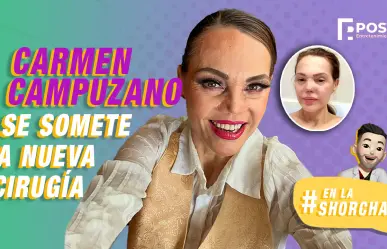 Carmen Campuzano se somete a cirugía tras "perforación" en la nariz causada por unos lentes