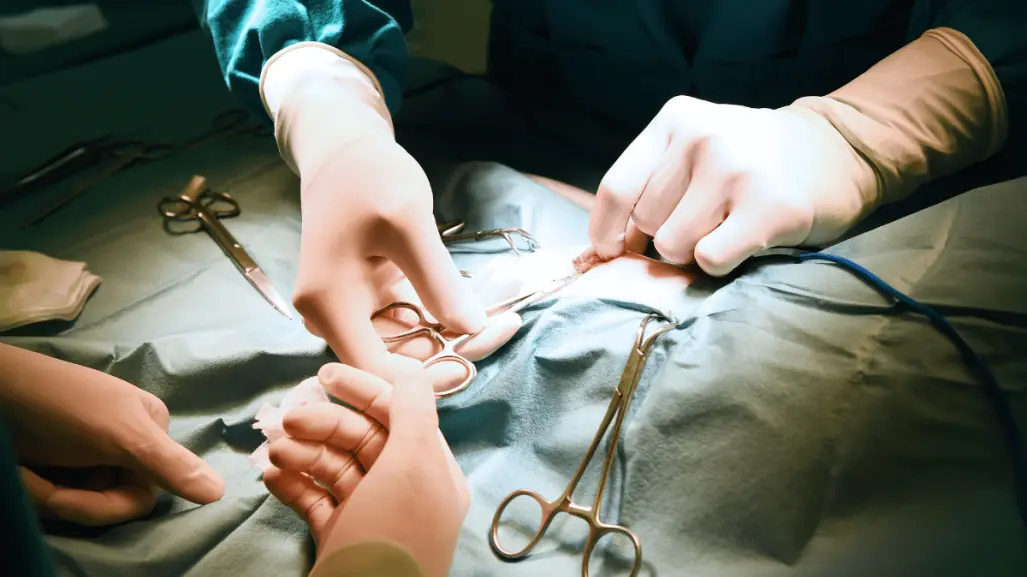 Costos de cirugía estética en Monterrey: ¿Por qué la gente viaja para operarse?