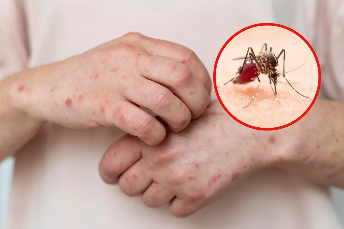 En Tamaulipas existen 108 casos positivos de dengue | Foto: Daniel Espinoza