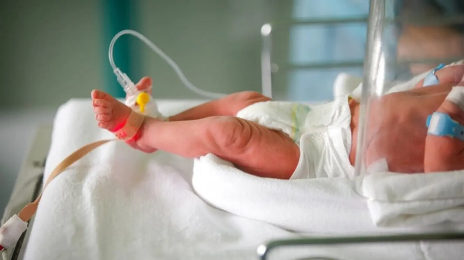 En lo que del 2025 se han registrado dos casos de bebés con un mortal defecto de nacimiento. Foto: Internet.