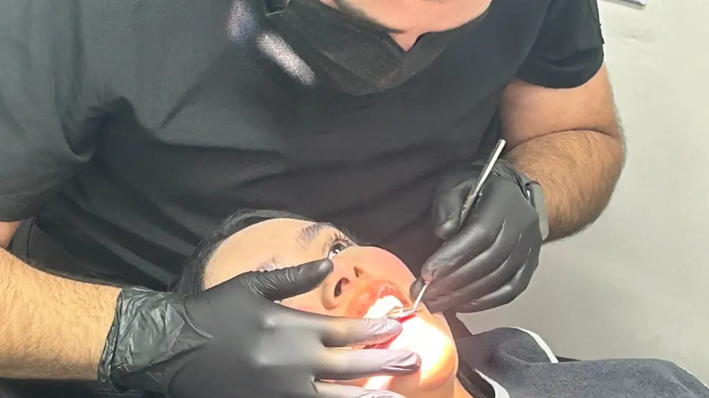 Carillas dentales: la tendencia estética que conquista Nuevo León