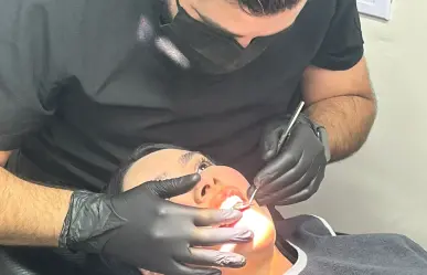 Carillas dentales: la tendencia estética que conquista Nuevo León