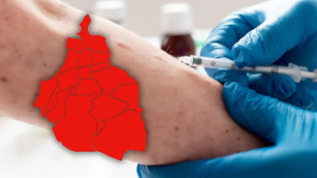CDMX en el Top 3 de Estados con más casos probables de sarampión, 3 contagios confirmados