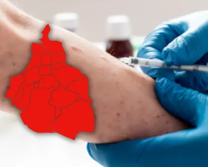 CDMX en el Top 3 de Estados con más casos probables de sarampión, 3 contagios confirmados