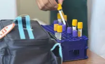IMSS-Bienestar acerca análisis clínicos a comunidades del Edomex con Laboratorio en tu Clínica