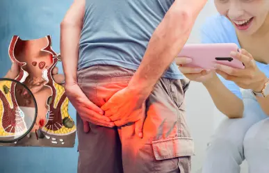 ¿Usar el celular en el baño provoca hemorroides? Esto dice un estudio
