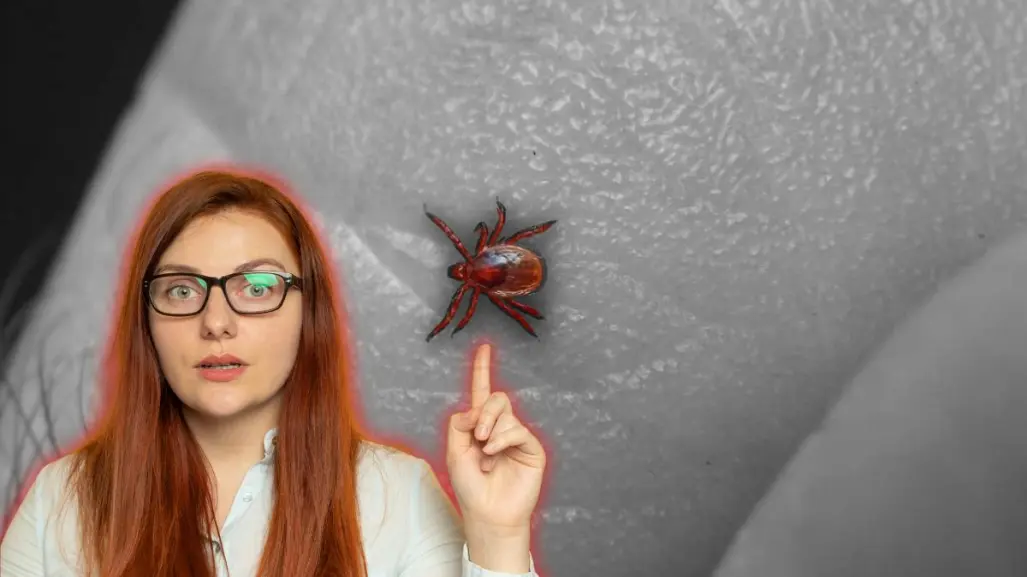 ¡Evita la rickettsiosis! descubre qué hacer ante la presencia de garrapatas en Nuevo León