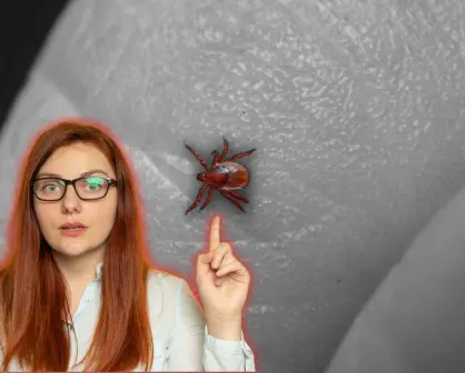 ¡Evita la rickettsiosis! descubre qué hacer ante la presencia de garrapatas en Nuevo León