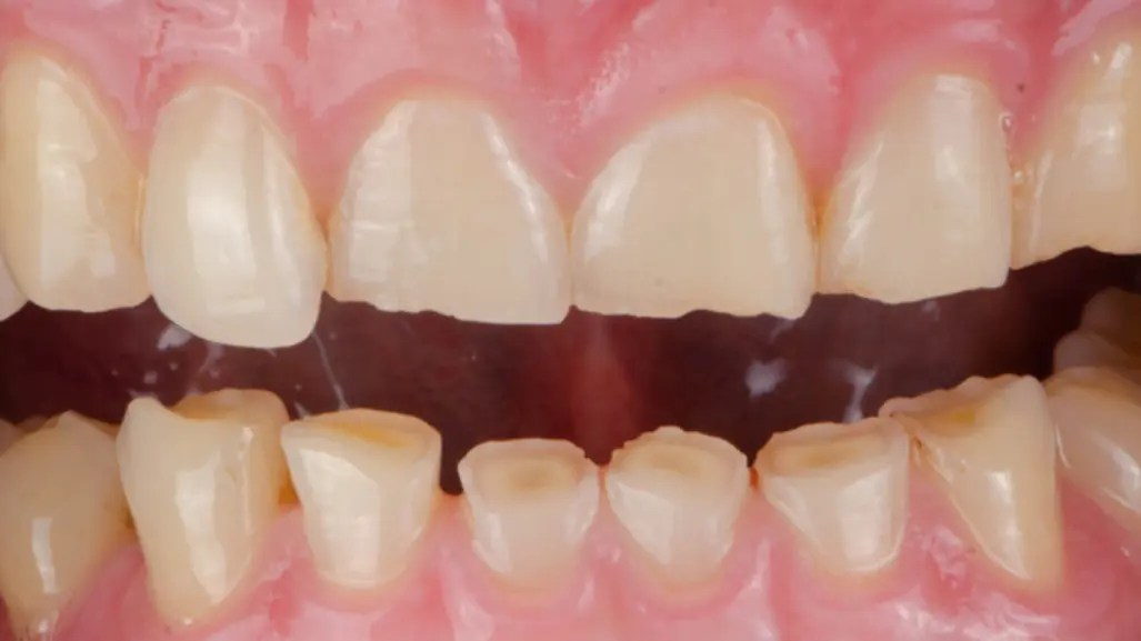 Este es el Congreso que no debe perderse la sociedad dental de Tamaulipas