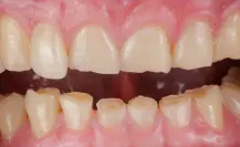 Este es el Congreso que no debe perderse la sociedad dental de Tamaulipas