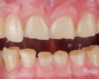 Este es el Congreso que no debe perderse la sociedad dental de Tamaulipas