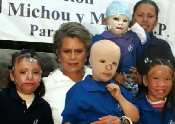 Fundación Michou y Mau y hospital en Texas brindan ayuda a niños tras explosión en Iztapalapa
