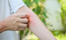 ¿Cuántos casos de dengue hay en BCS? Esto dice la SSA