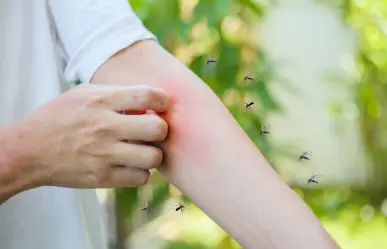 ¿Cuántos casos de dengue hay en BCS? Esto dice la SSA